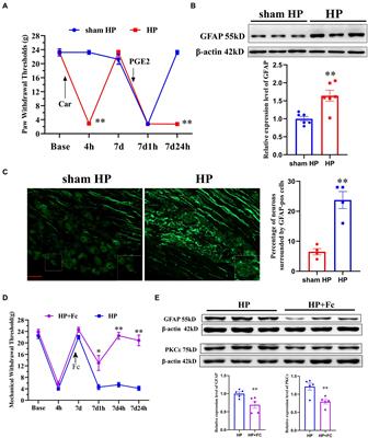 Satellite glial cells drive the transition from acute to chronic pain in a rat model of hyperalgesic priming